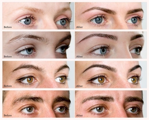 Before and After Threading
